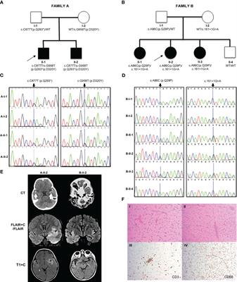 Neuroinflammation, autoinflammation, splenomegaly and anemia caused by bi-allelic mutations in IRAK4